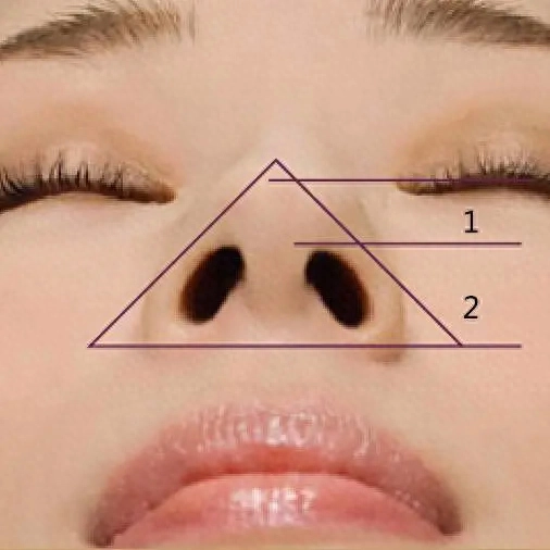鼻子美不美怎么办？鼻小柱有哪些重要性？